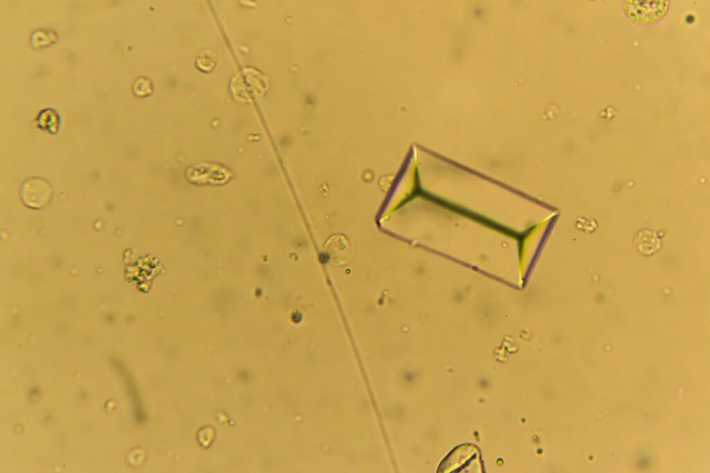 Fotografia de um cristal de estruvita. Os cálculos urinários nos cães são gerealmente de estruvita