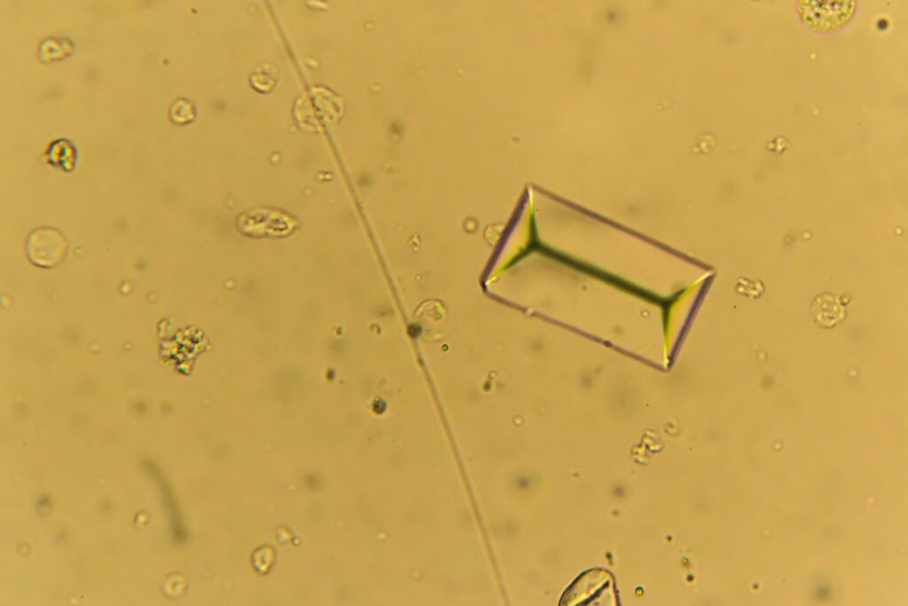 cálculos_2 Fotografia de um cristal de estruvita. Os cálculos urinários nos cães são gerealmente de estruvita