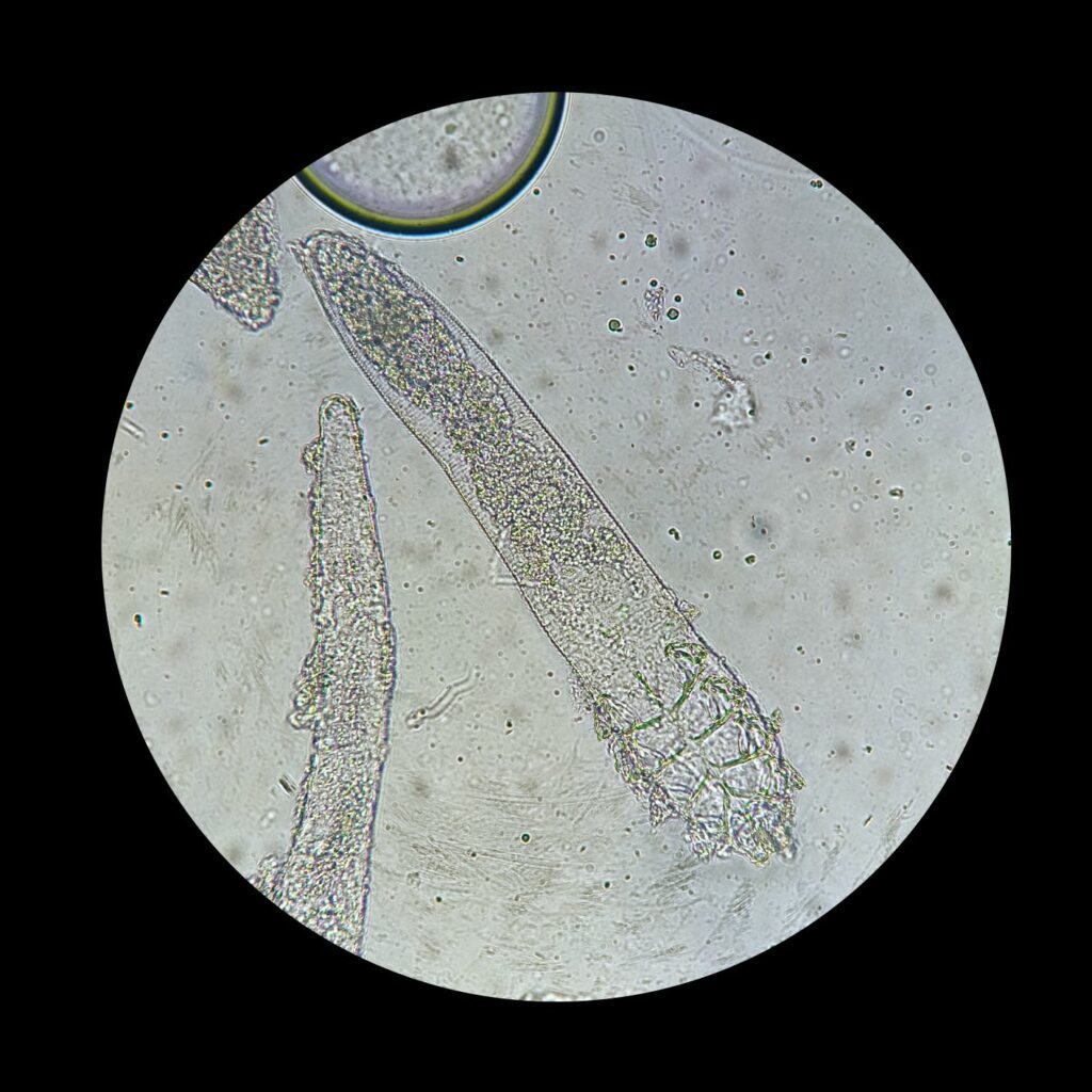 ácaros demodex no microscópio