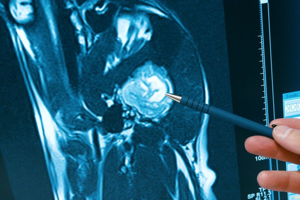 Female hand pointing on dog brain sagitalis on MRI image Ressonancia magnética ao cérebro de um cão